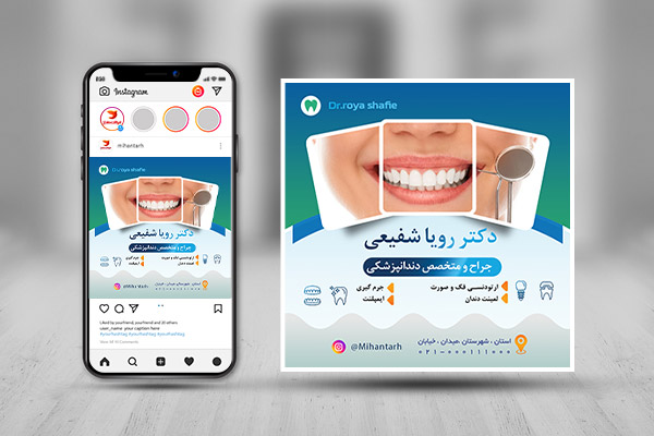 طرح لایه باز پست اینستاگرام دندانپزشکی